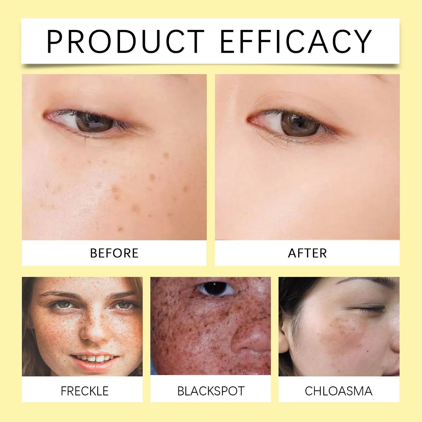 OUHOE Astragalus Moisturizing Cream - Even Skin Tone, Deep Moisturize, Light Texture, All Skin Types, Daily Use